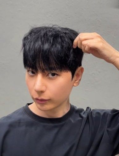 텍스처 쉐도우펌 시술 사진