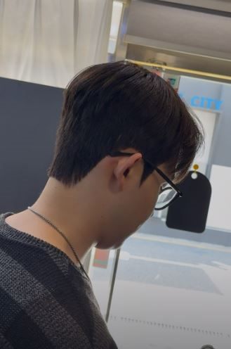 디자인 다운컷 시술 사진