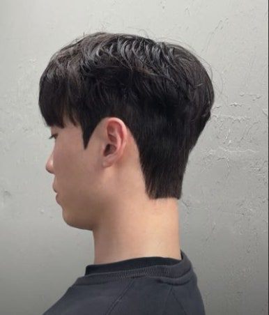 디자인 다운컷 시술 사진