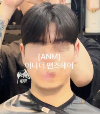세미리프 시술 사진 — 얼굴 옆선을 부드럽게 감싸는 남자 머리