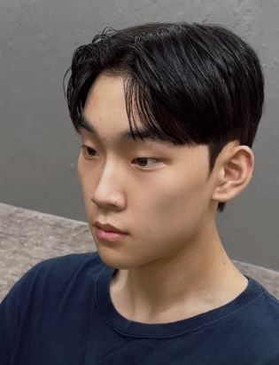 세미리프 시술 사진