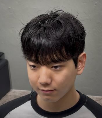 테일펌 시술 사진